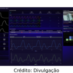 Imagem de uma máquina monitorando batimentos cardiácos e paciente.