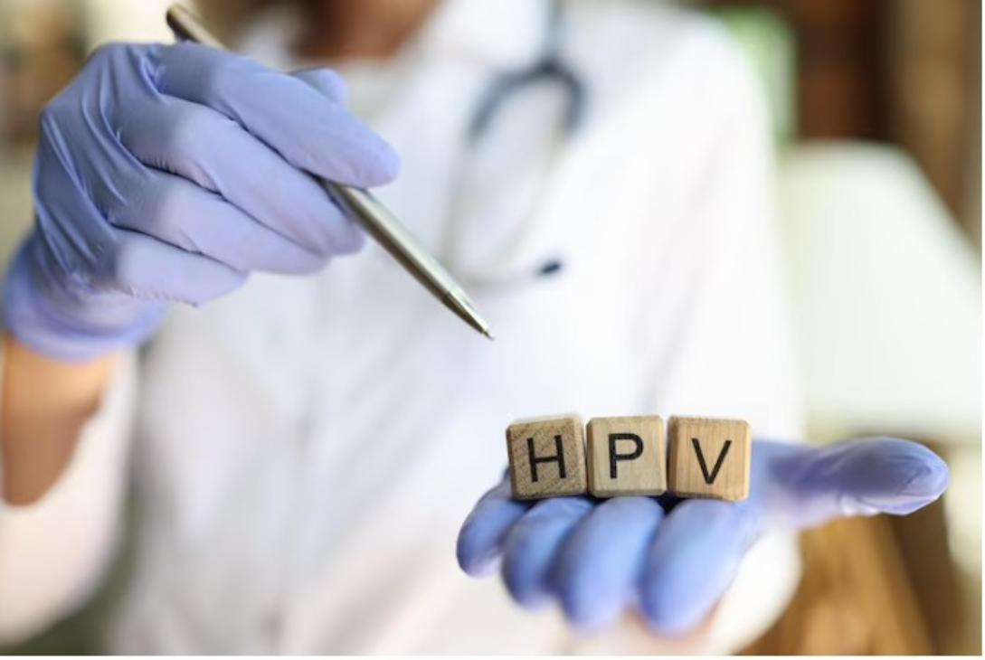 Foto ilustrativa de um médico segurando uma pinça e três dados com letras que formam a palavra HPV.